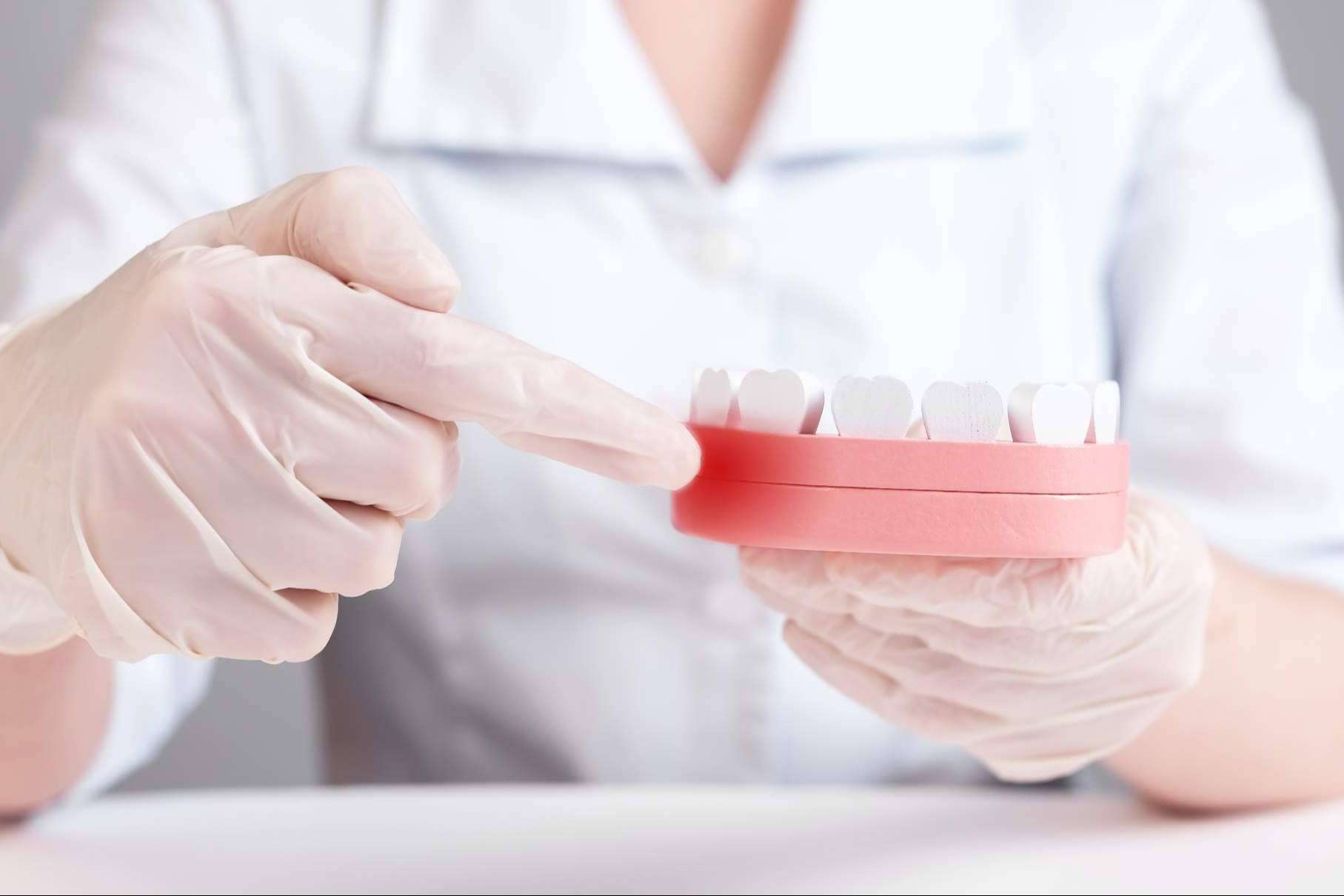 Tratamientos de periodoncia de la mano de odontólogos especializados, en Clínica Dental Delgado
