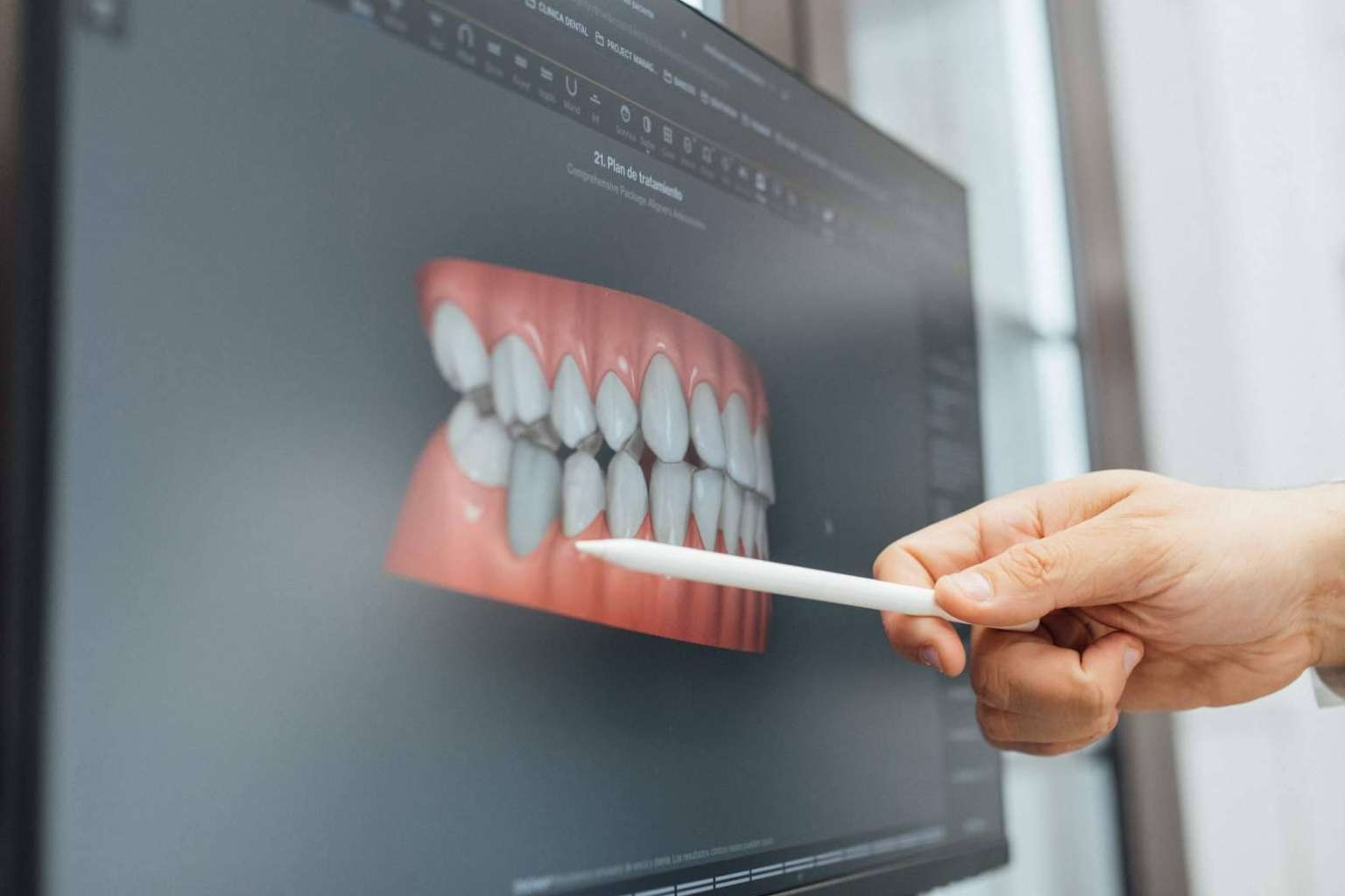 Todo lo fundamental sobre la ortodoncia invisible en Barcelona, con Clínica Dental Claris