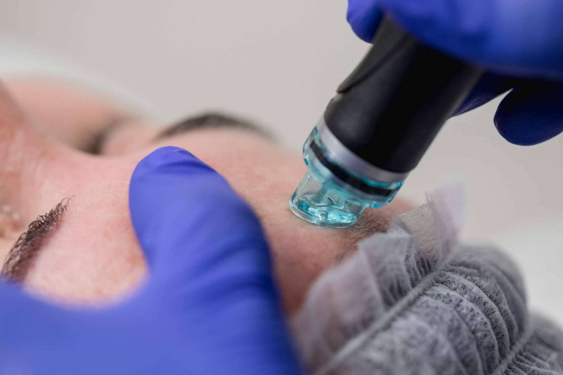 El tratamiento estrella, Hydrofacial, llega a Oviedo de la mano de la Clínica Sánchez del Río