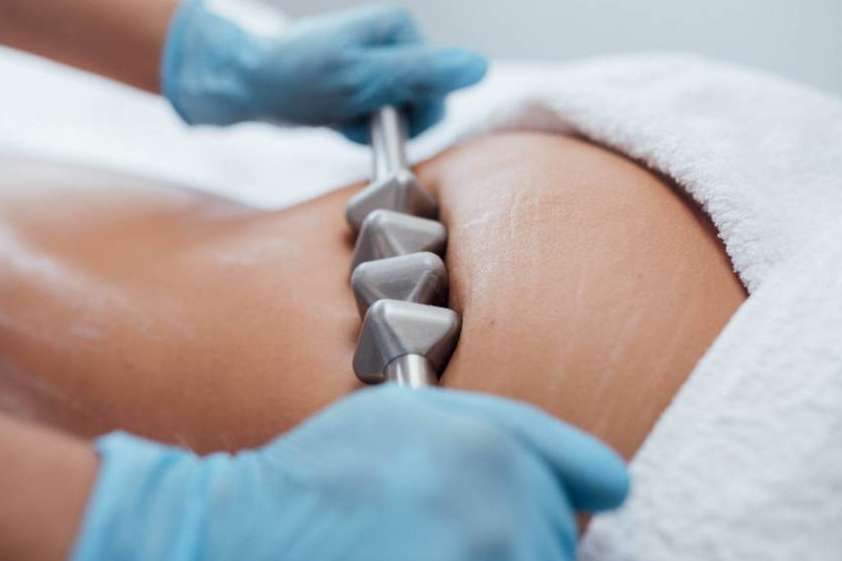 Combatir celulitis, grasa y remodelar glúteos