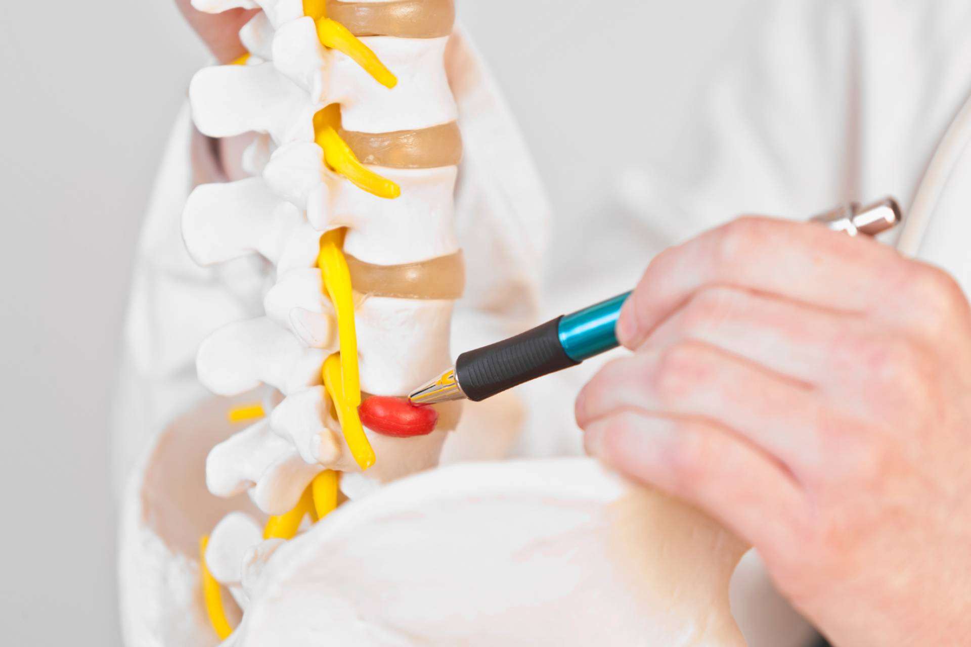 Hernia discal y andulación, un enfoque terapéutico innovador
