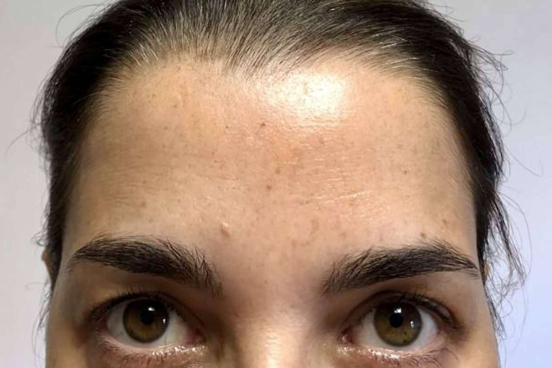 Clínica Amalfi ofrece un tratamiento de rejuvenecimiento facial para lucir un aspecto joven y natural
