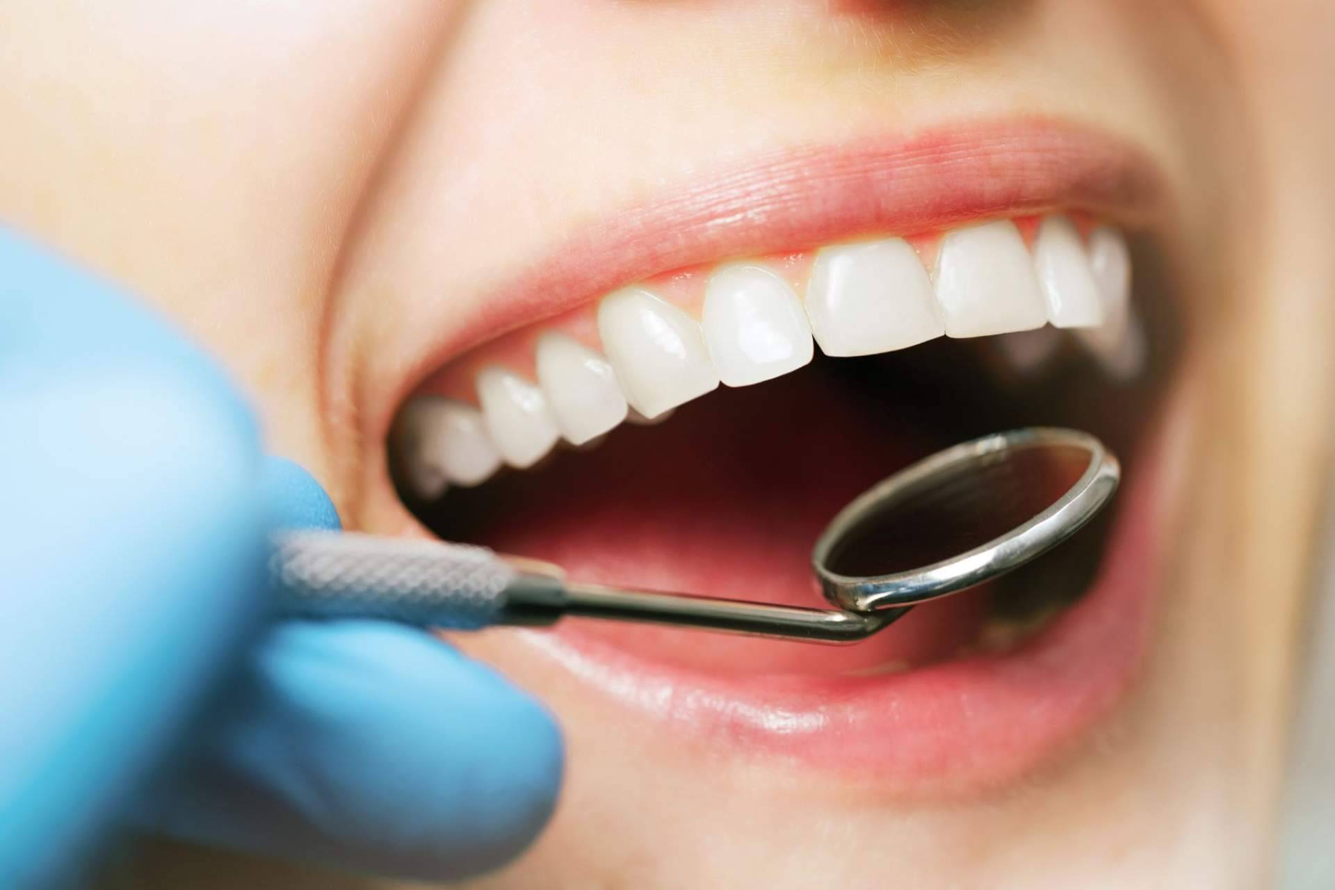 ¿Cuáles son las claves para tener salud bucodental? Farmasky