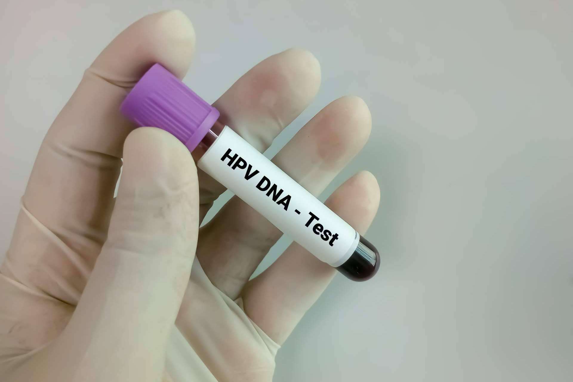 Carmen de Endosofia explica qué es exactamente el virus del papiloma humano