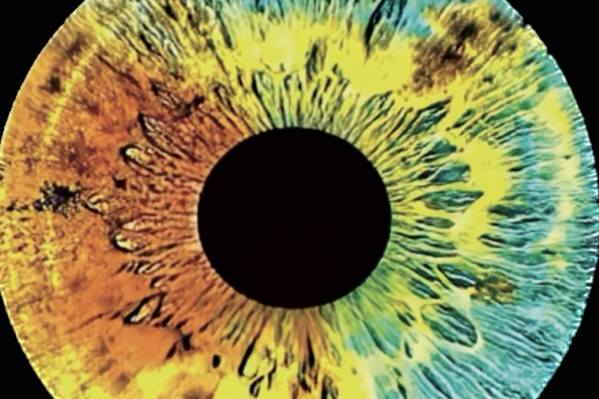 Clínica Eyecos investiga los genes del color de ojos
