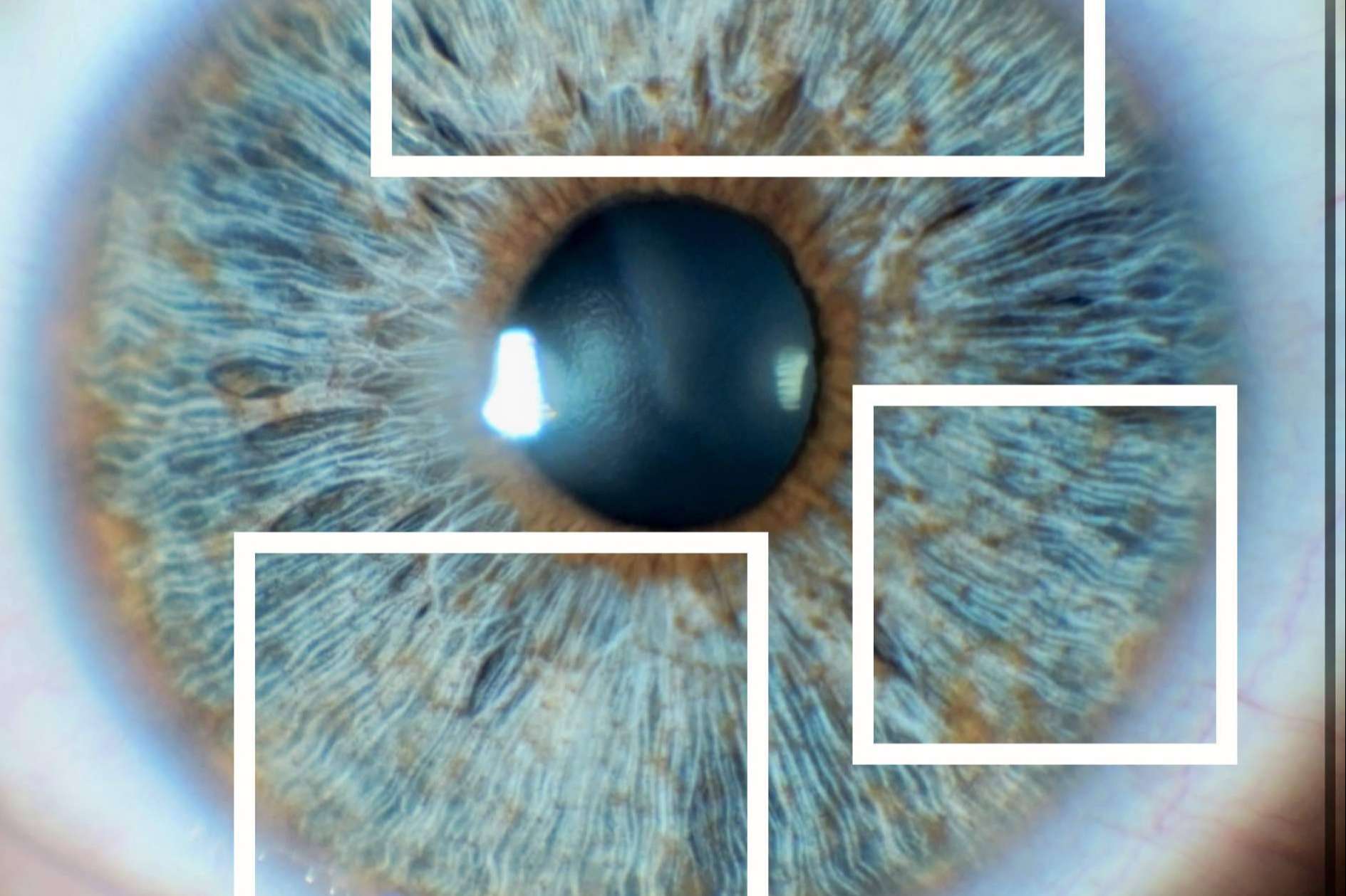 Colágeno del iris y su importancia en el brillo de los ojos