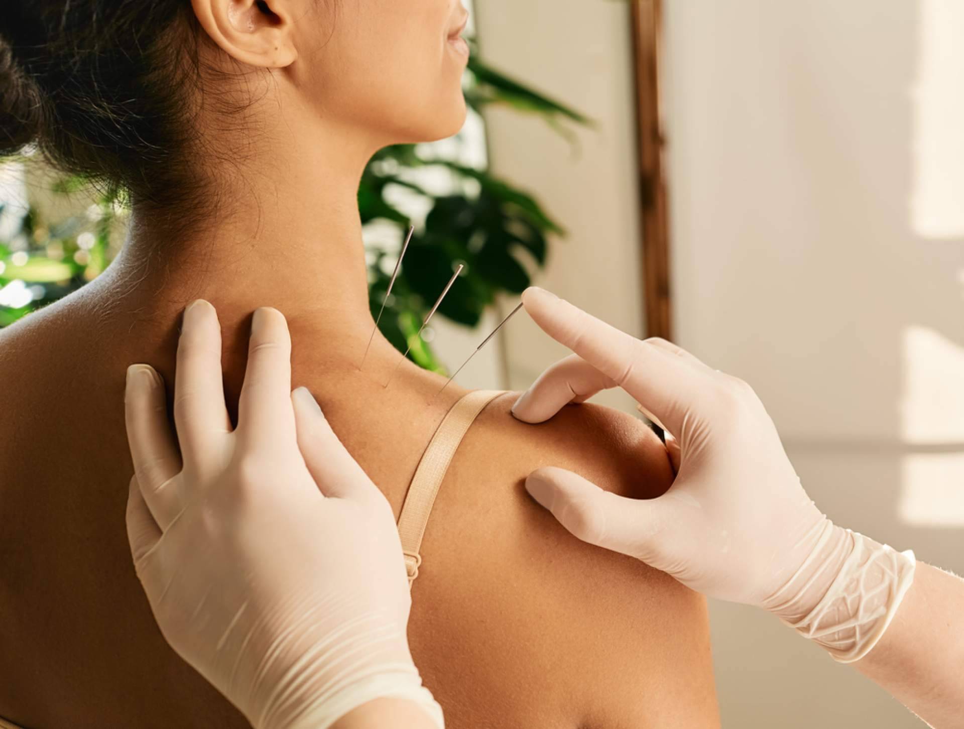 La acupuntura tiene múltiples beneficios para la fertilidad, según Shenti Wellness