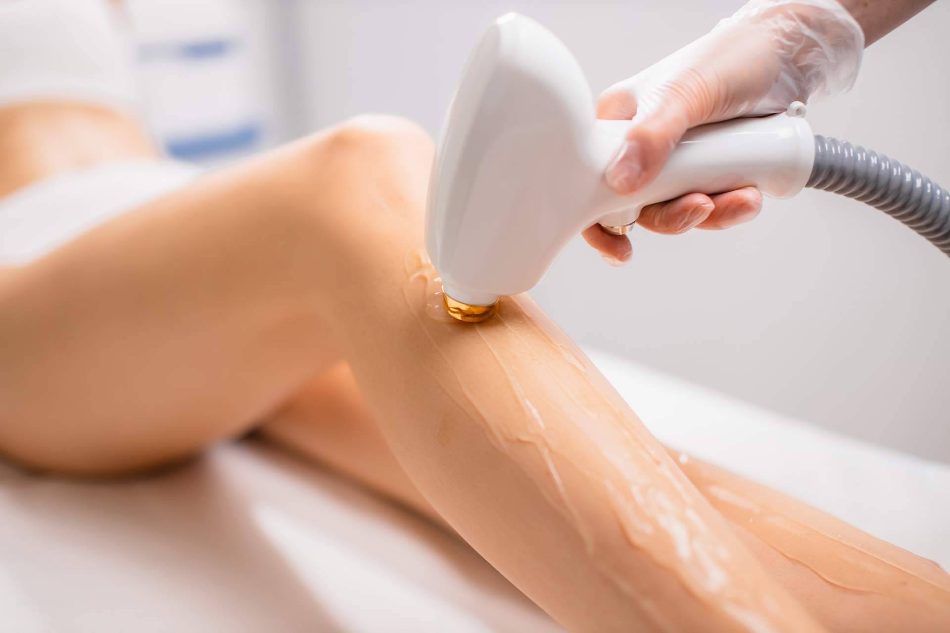 ¿Dónde encontrar especialistas en depilación láser cuerpo completo? 360Clinics