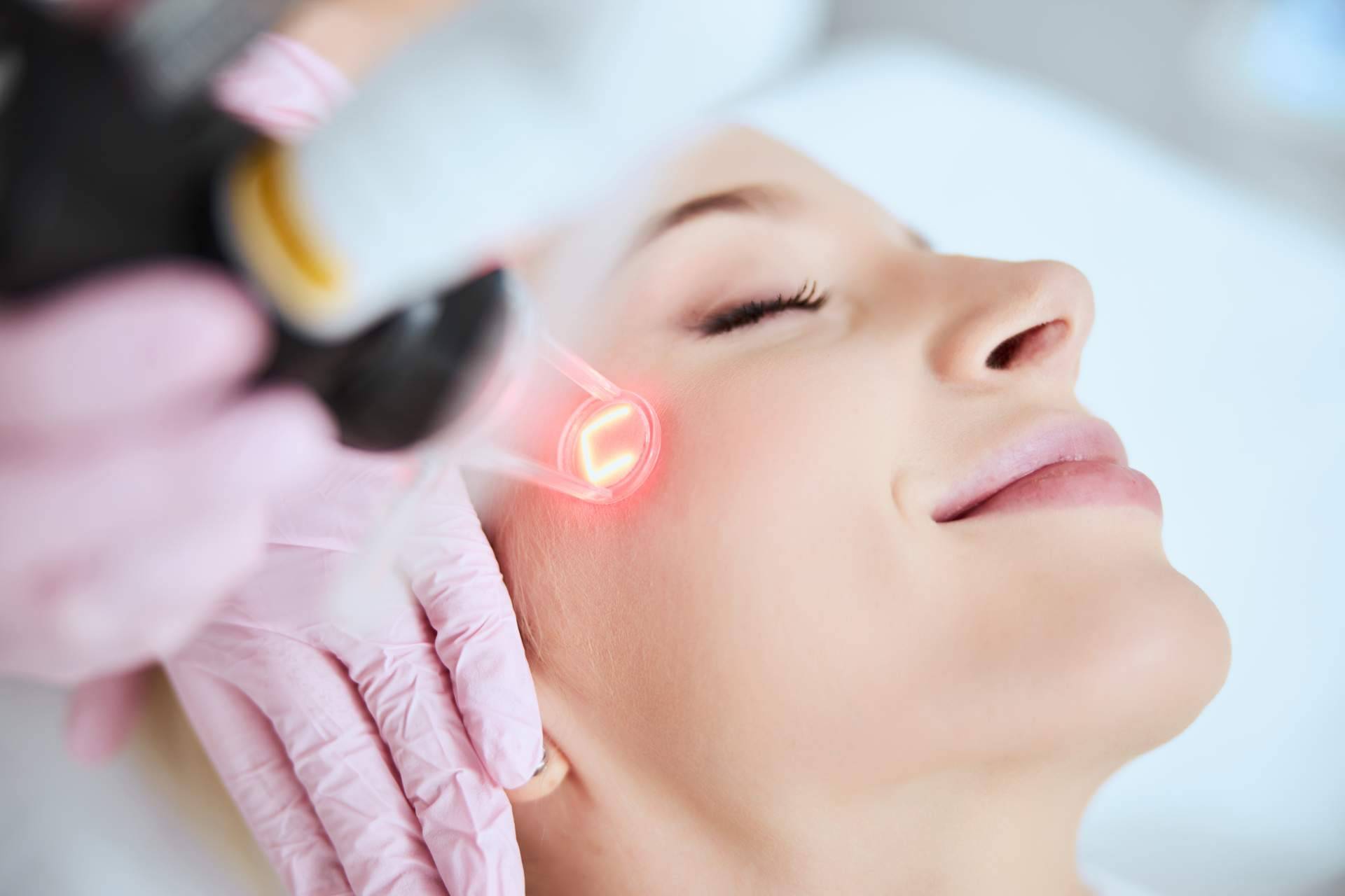 En Elegansse se realiza el tratamiento de láser CO2 resurfacing facial
