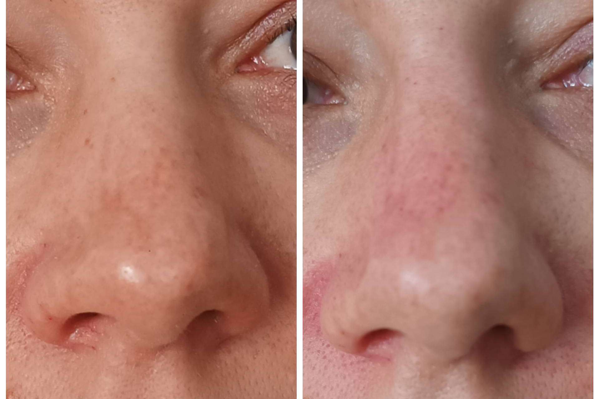 Clínica Calvo de Mora ofrece medicina estética facial y dental para una sonrisa perfecta