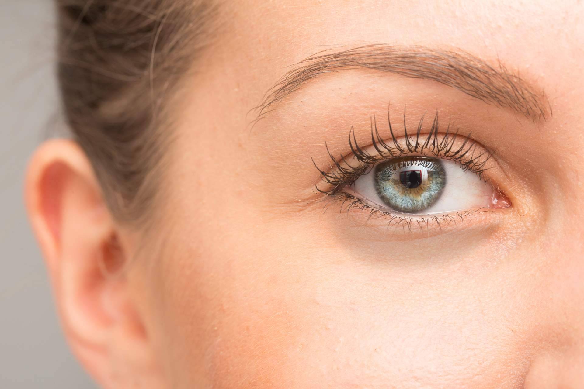 El tratamiento de ojeras con ácido hialurónico que realiza Alluring Clinic