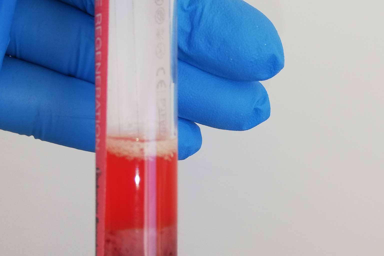 Clínica Biorigenera pone a disposición terapias con células madre