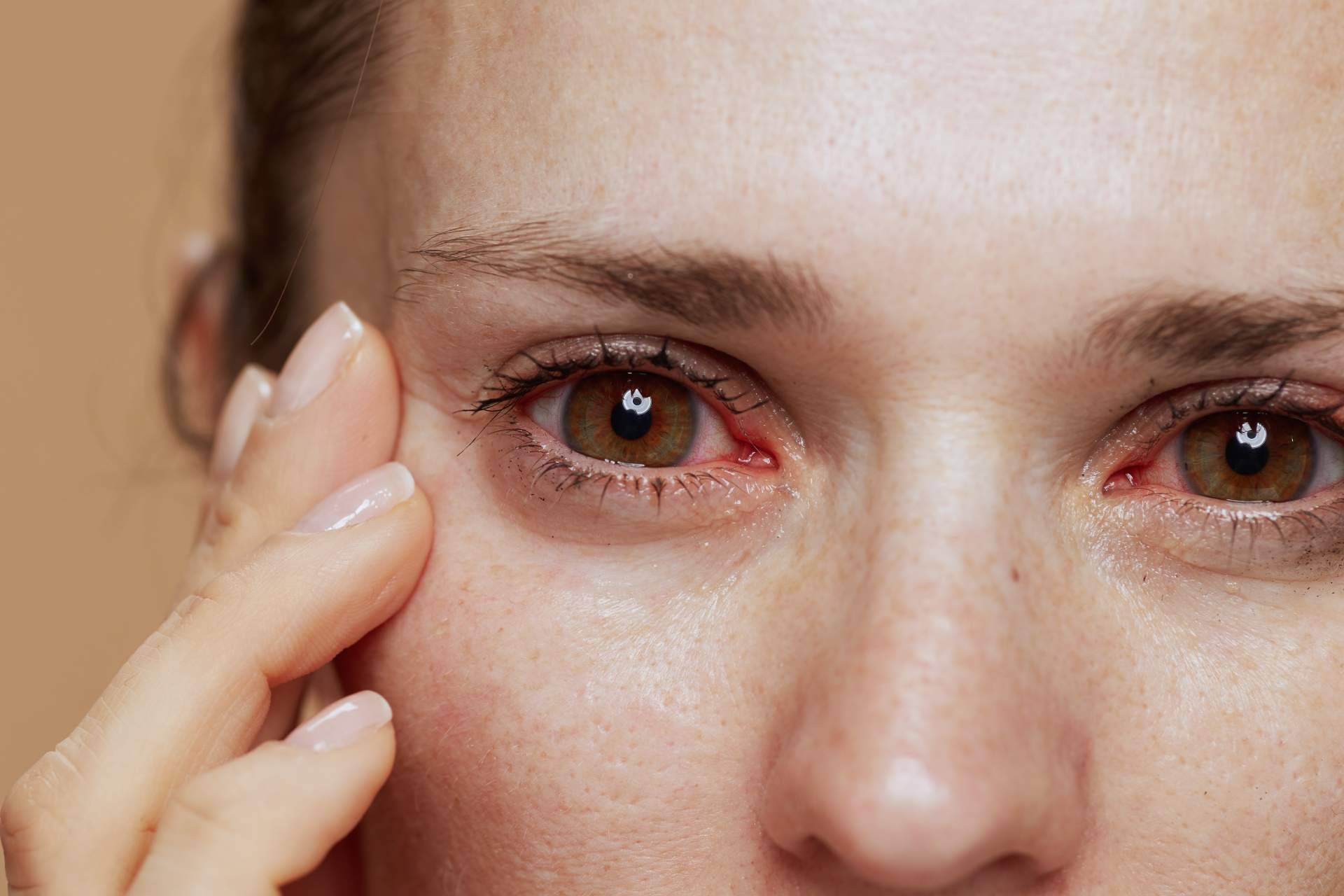 La solución ideal para combatir el ojo seco