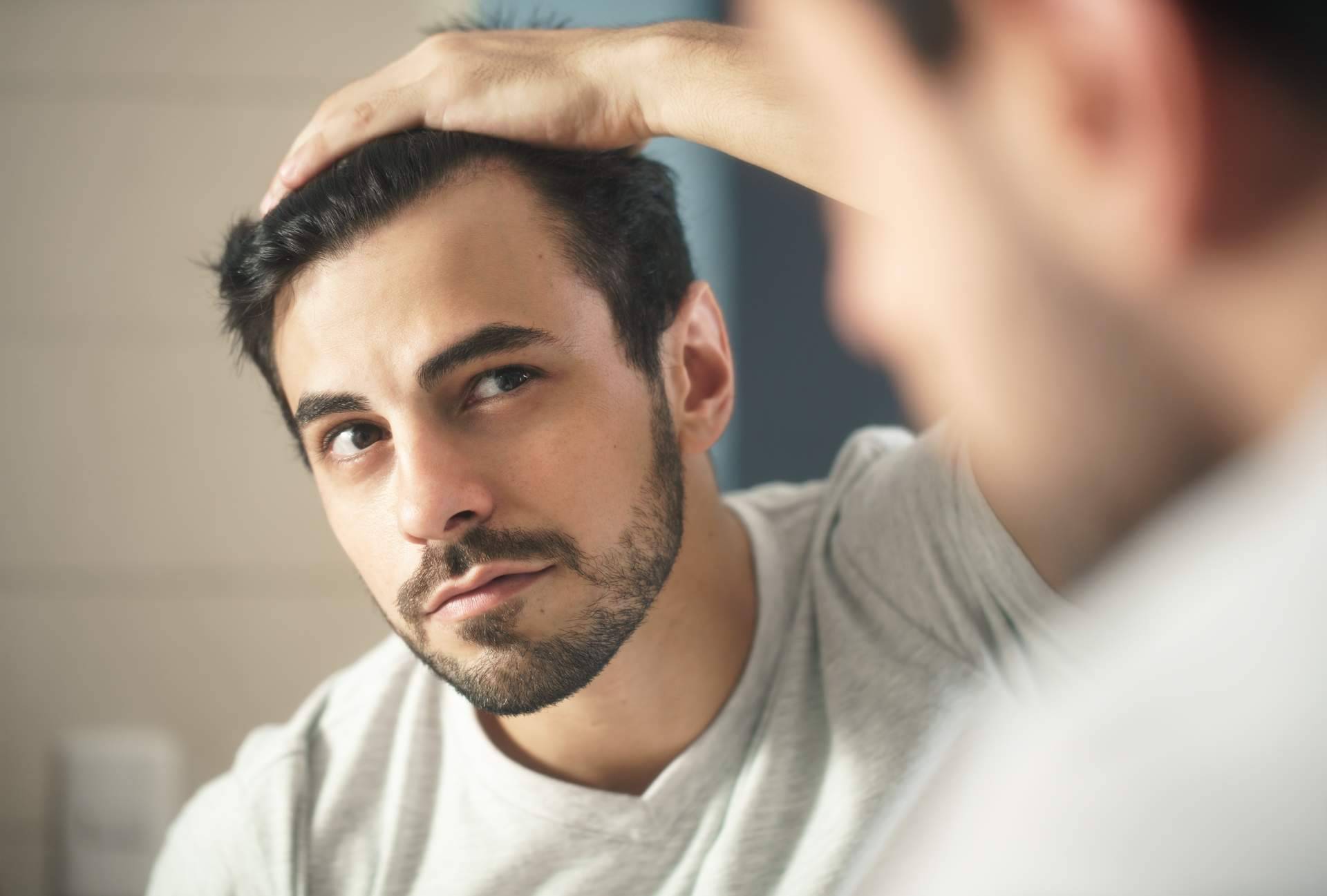 Xpecia hombre, una solución para combatir la alopecia