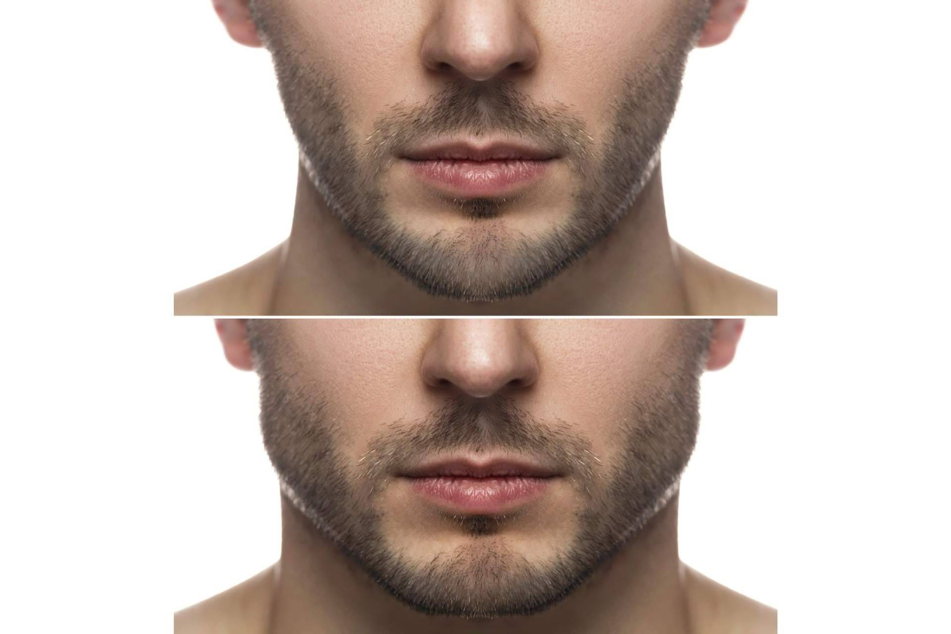 Tendencias emergentes y enfoques personalizados en la medicina estética masculina