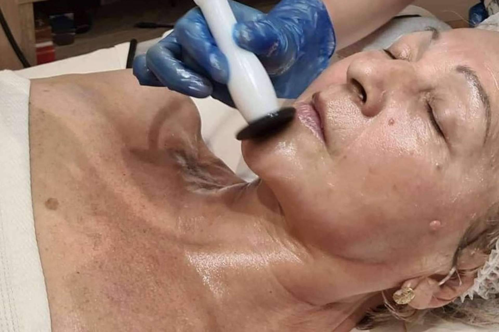 Tratamiento de radiofrecuencia de referencia en Madrid con Crina Rus Beauty Center