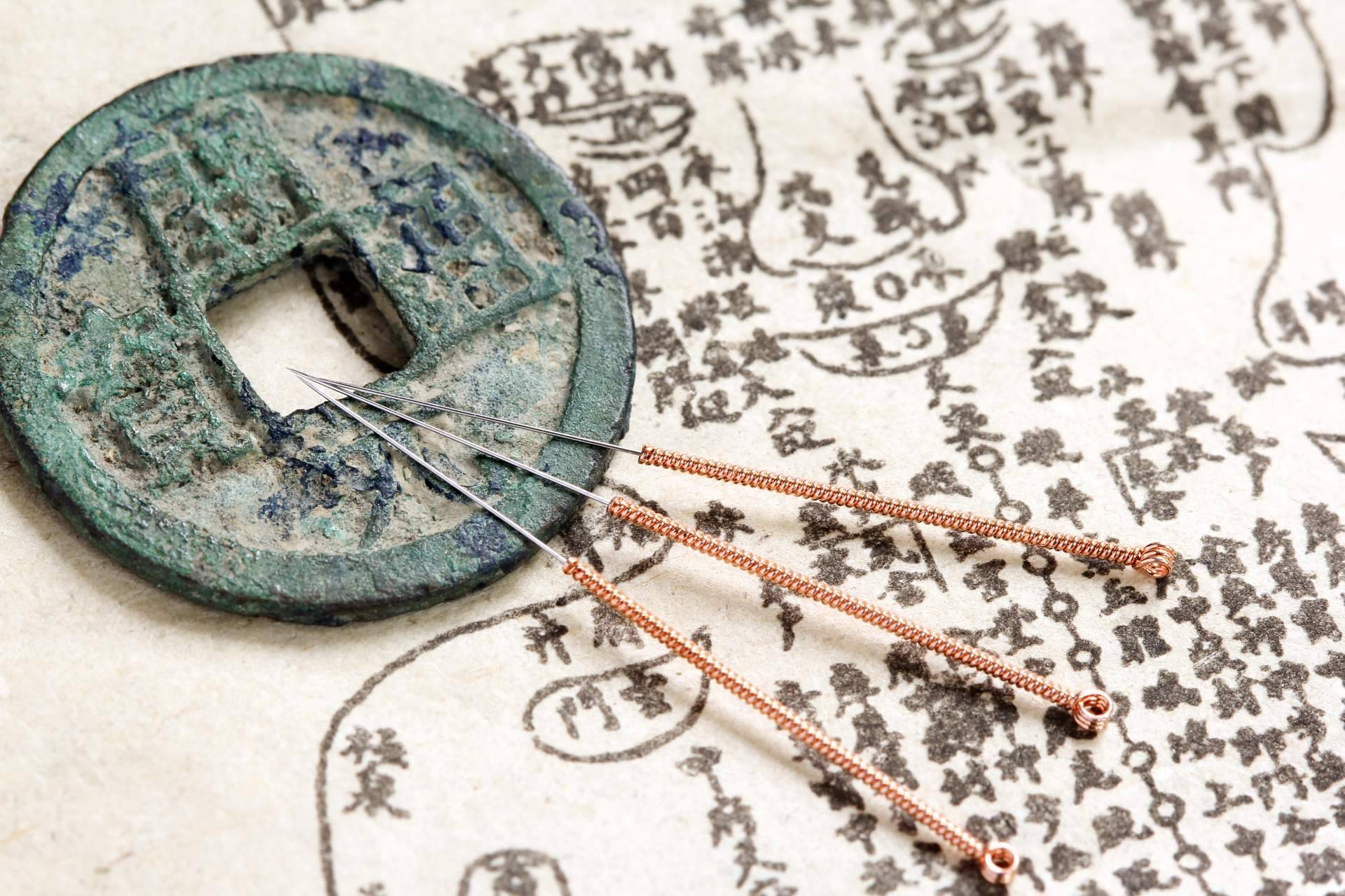 La Medicina Tradicional China es una manera no invasiva de lograr la curación