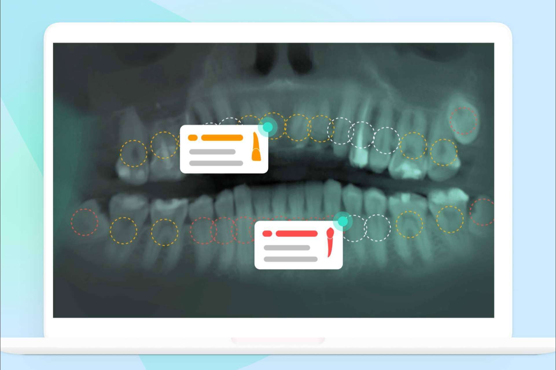La práctica odontológica, revolucionada por Dentomo, el diagnóstico potenciado por inteligencia artificial