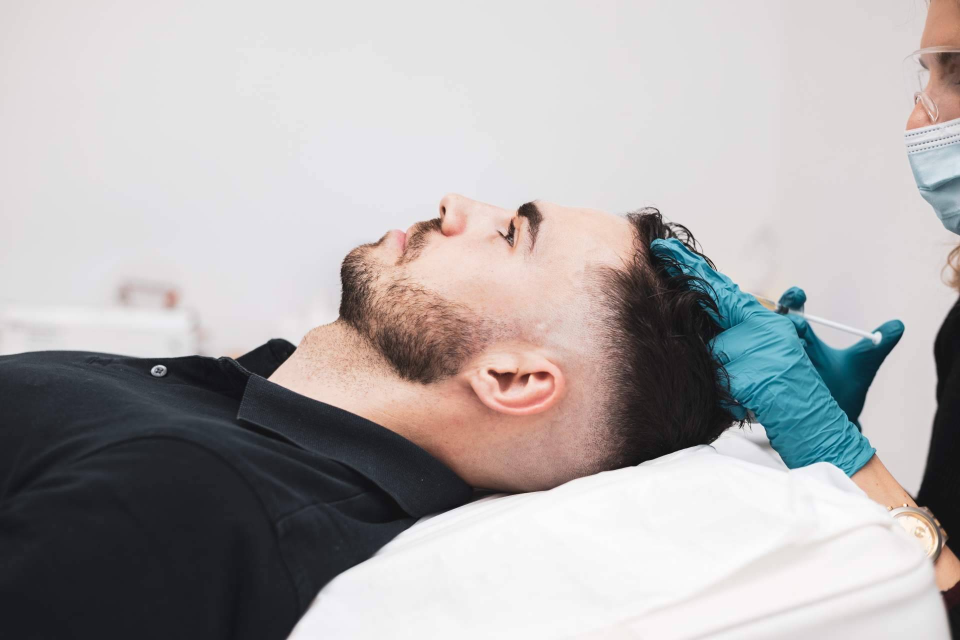 Los tratamientos de injerto capilar en Madrid que realiza el Doctor Jesús Aníbal Mora en Capilar Innovation Clinic