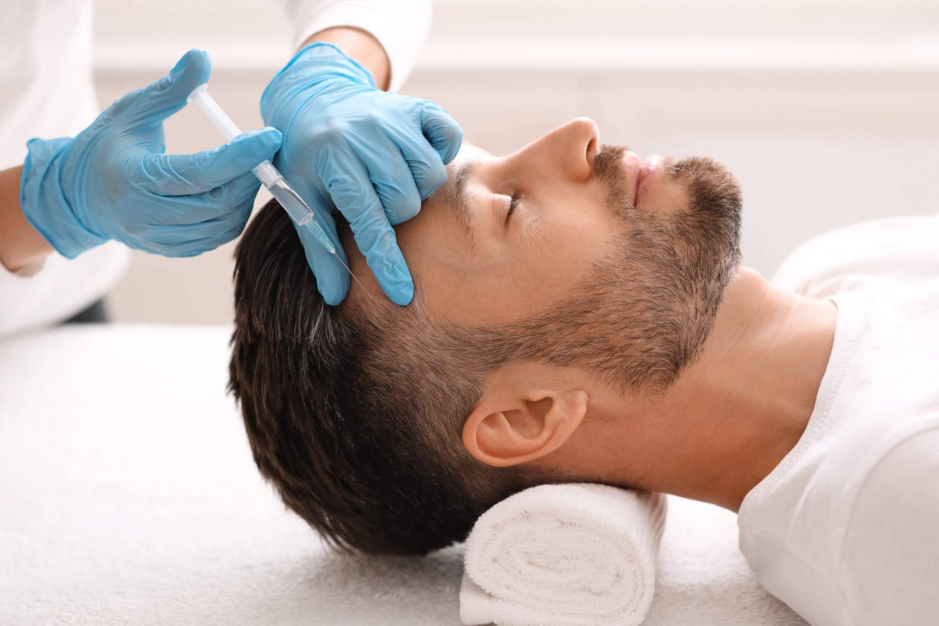 Tratamiento de la alopecia androgenética con exosomas, un método innovador que llega de la mano de Alluring Clinic