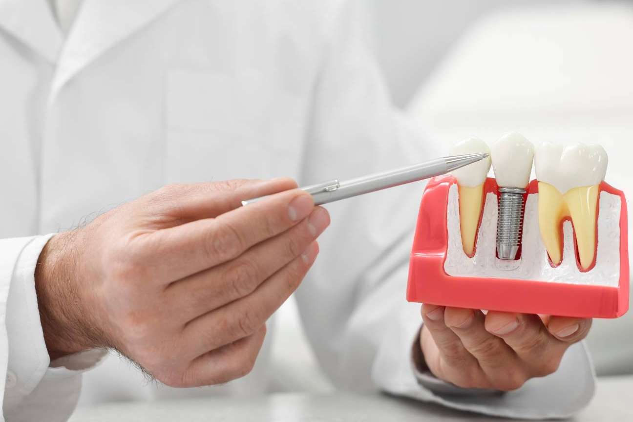 Los 10 requisitos para encontrar una excelente clínica dental en Madrid