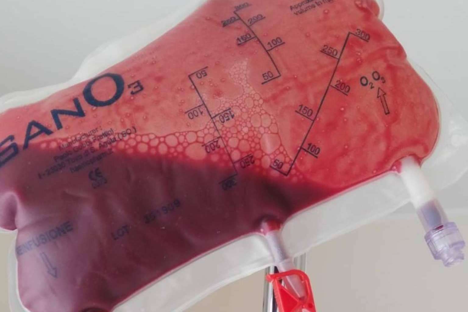 Tratar la diabetes y sus efectos con ozonoterapia de la mano de Biorigenera