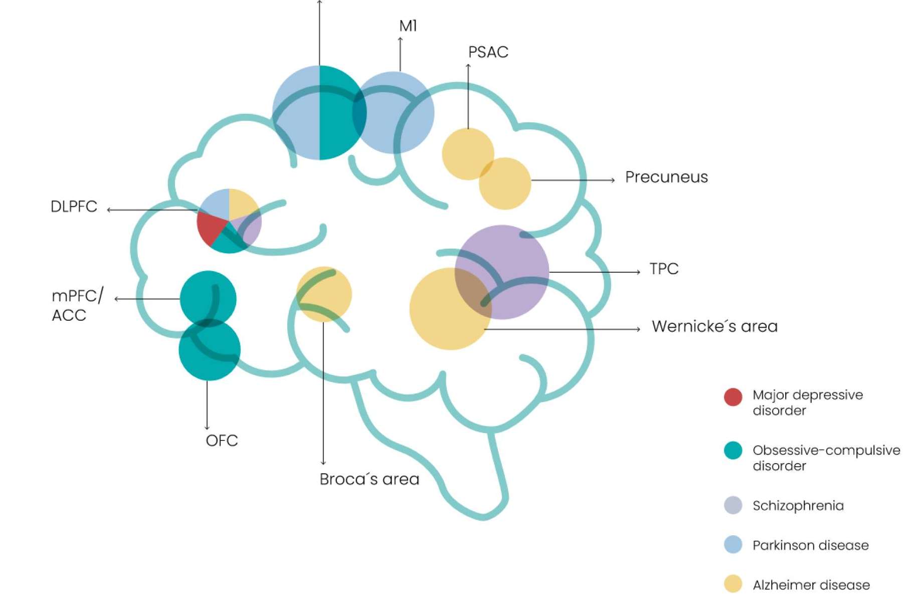 Unidad de neuromodulación de Clínica MHS y su innovador método de estimulación magnética contra el dolor crónico