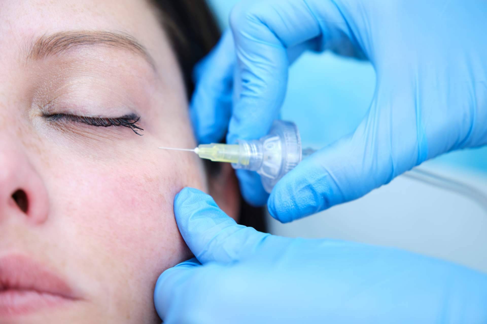 Cómo deshacerse de las ojeras con ácido hialurónico, en Centro Estética El Pilar