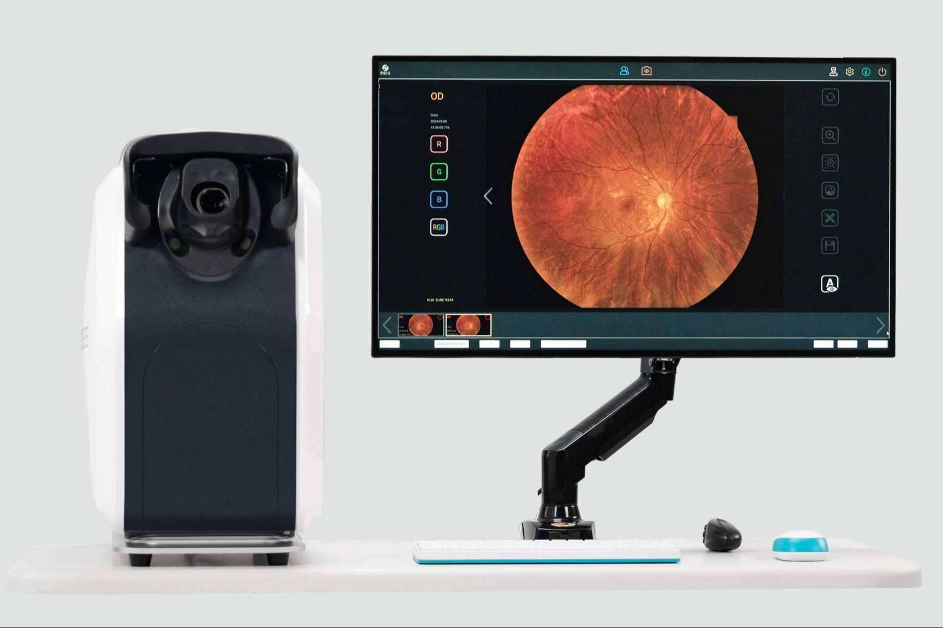 Detección rápida y precisa de anomalías en la retina con retinógrafos de campo amplio de GX2