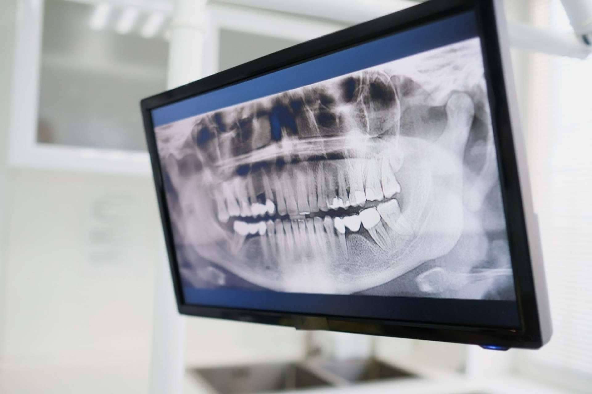 Dentydent ofrece servicios de odontología avanzada para una sonrisa saludable