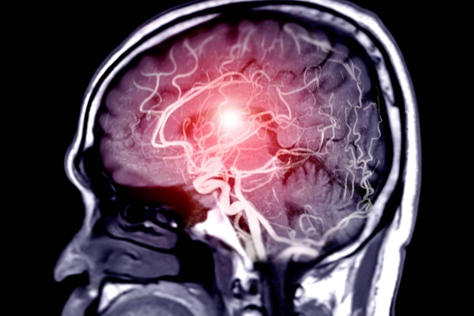 Radiología que salva vidas; el impacto clínico de la Dra. Claudia Martínez Higueros