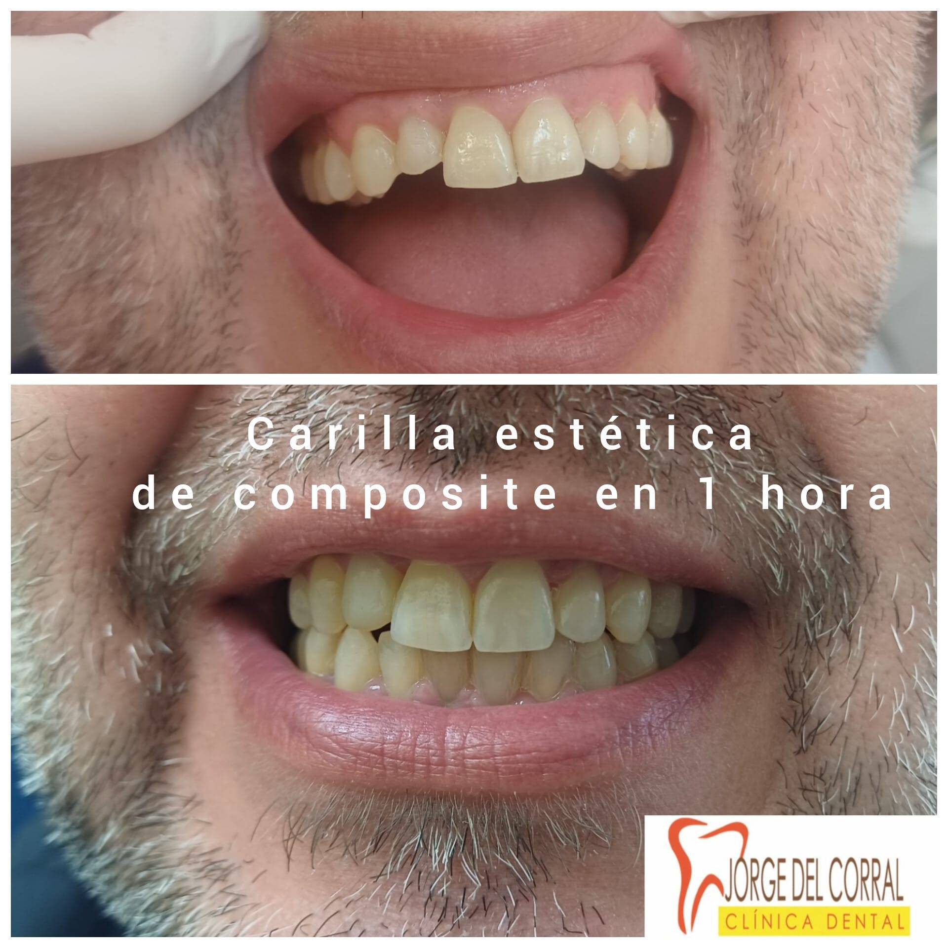 Estética dental de vanguardia con implantes, carillas, prótesis y ortodoncia en la Clínica Dental Jorge del Corral