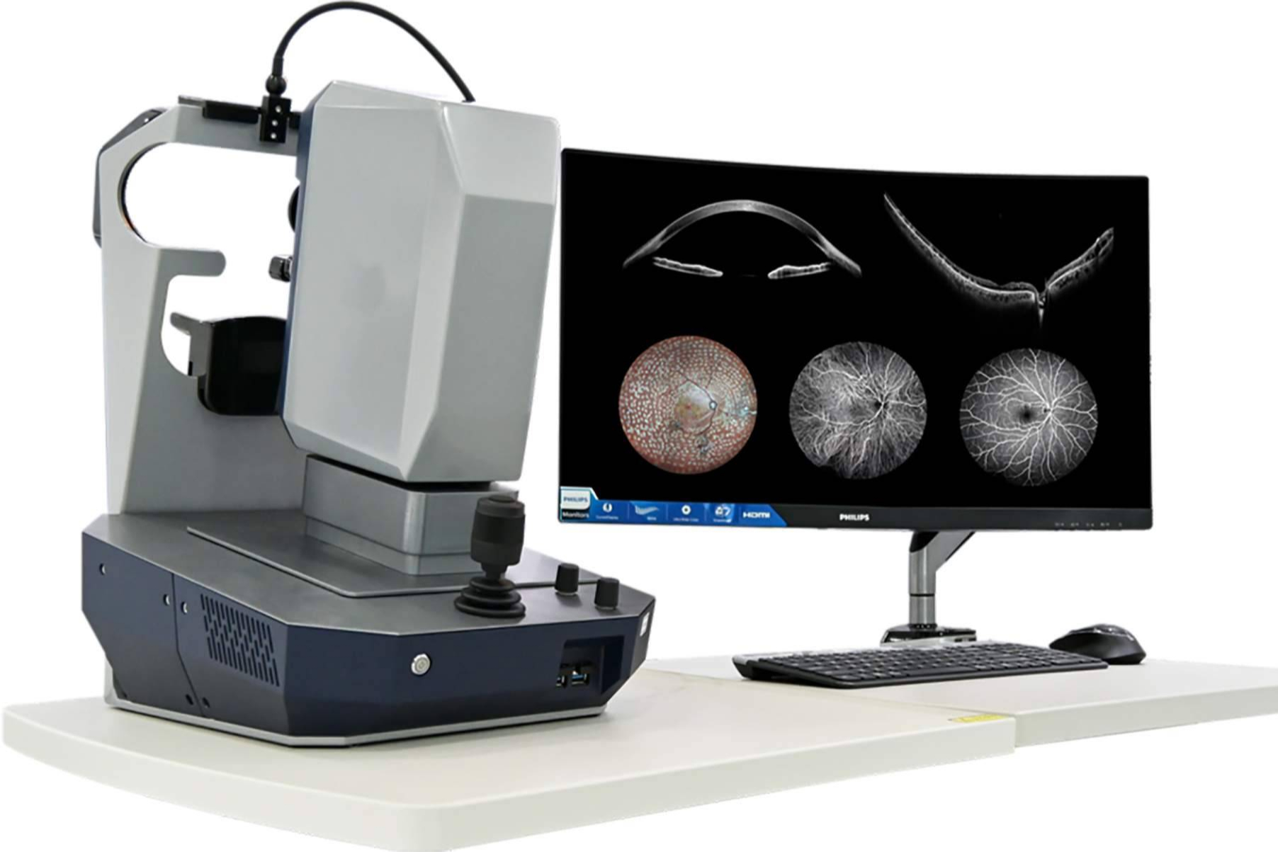 GX2 incorpora soluciones OCT de alta precisión para el diagnóstico ocular avanzado