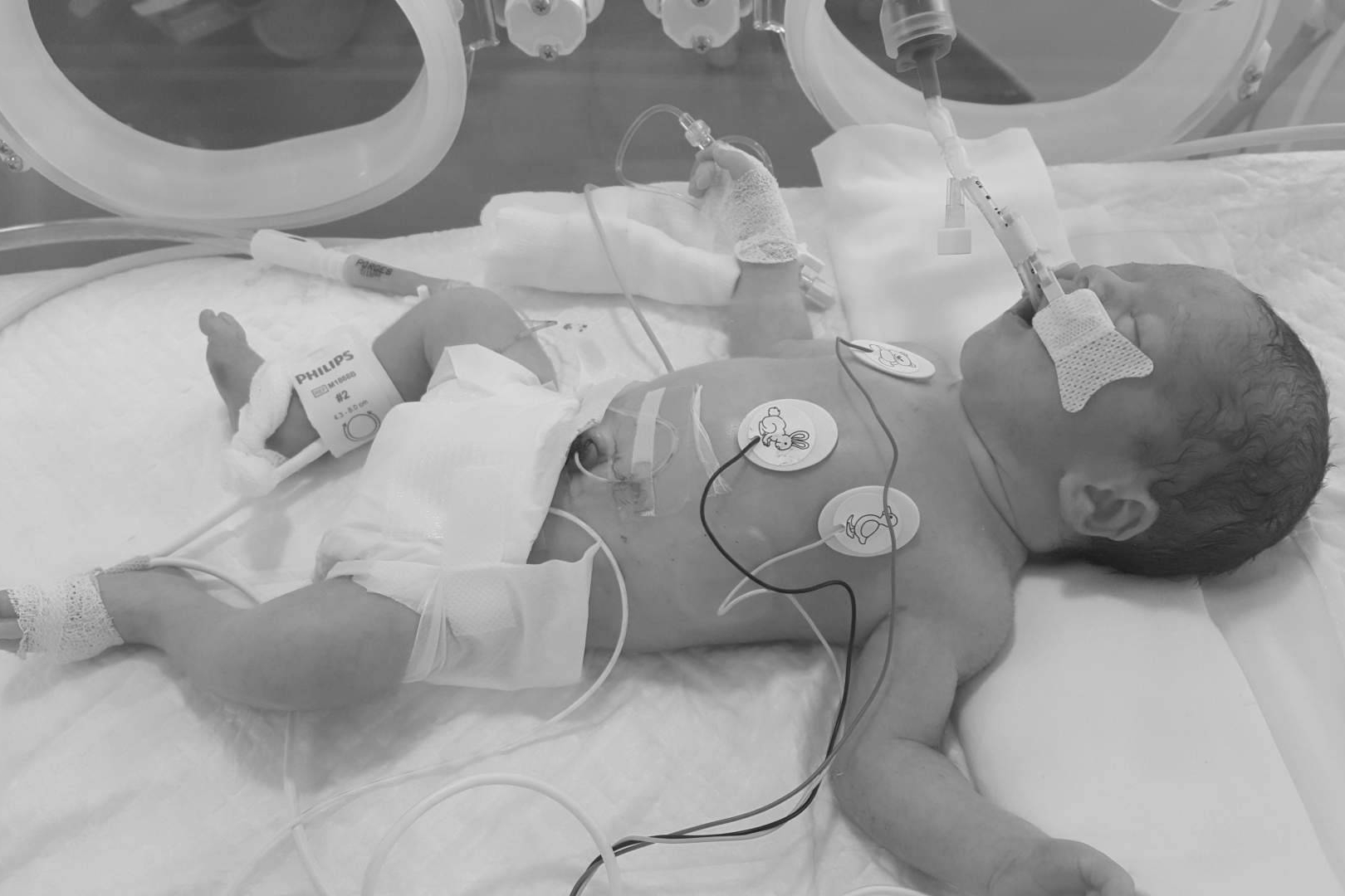 Cada bebé prematuro, una historia de lucha familiar en el Día Mundial de la Prematuridad