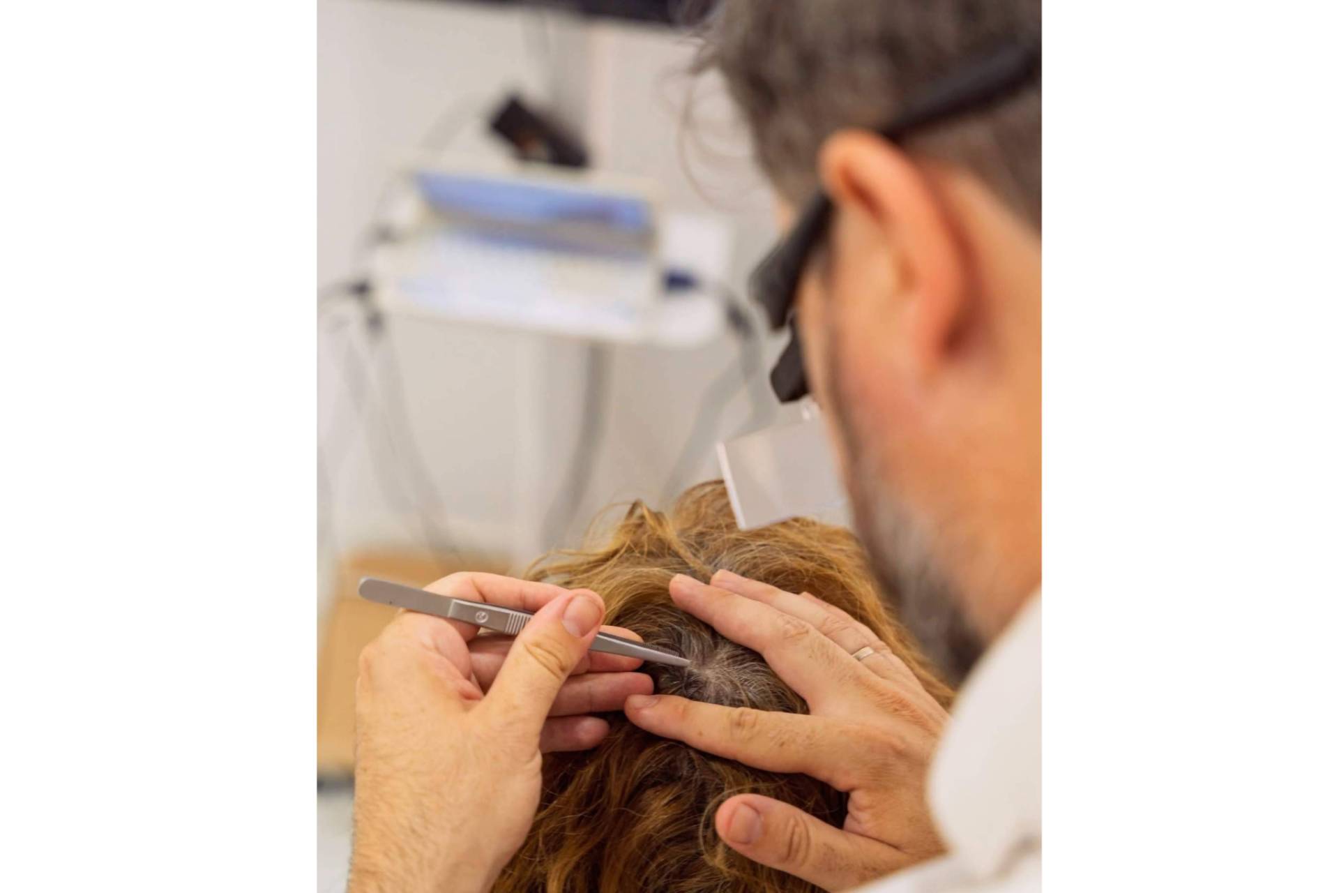 Pardo Centro Capilar une imagen, análisis y seguimiento para actuar ante la alopecia desde el diagnóstico capilar